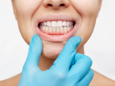 periodontal dentistry Odenton